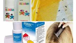 Спречување на педикулоза: како да се спречи инфекцијата на лагите